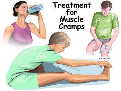 Treating Muscle Cramps | Gym Workout Gloves | WAGs