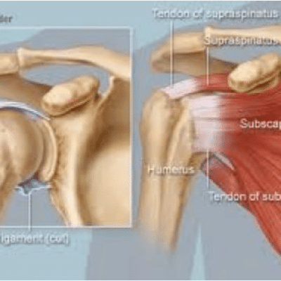 Treatment for Shoulder Injuries – Part 1